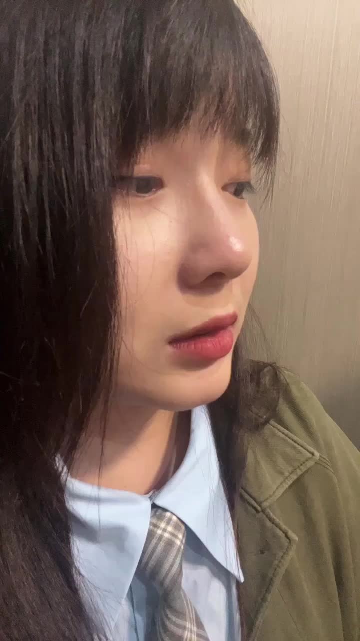 #肋骨鼻综合,#鼻子整形|四个月肋骨鼻综合➕鼻基底填充