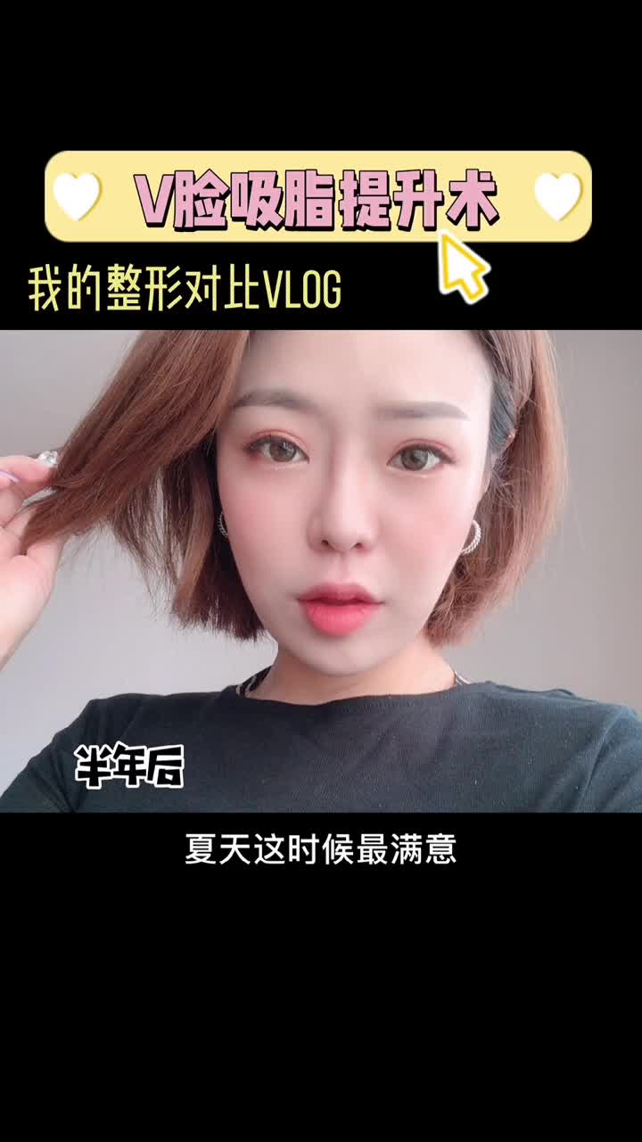 术后|打完瘦脸针，有效果吗？