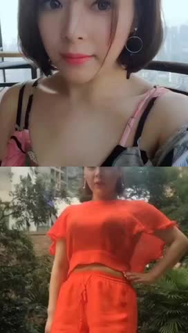 鼻综合➕眼综合恢复后