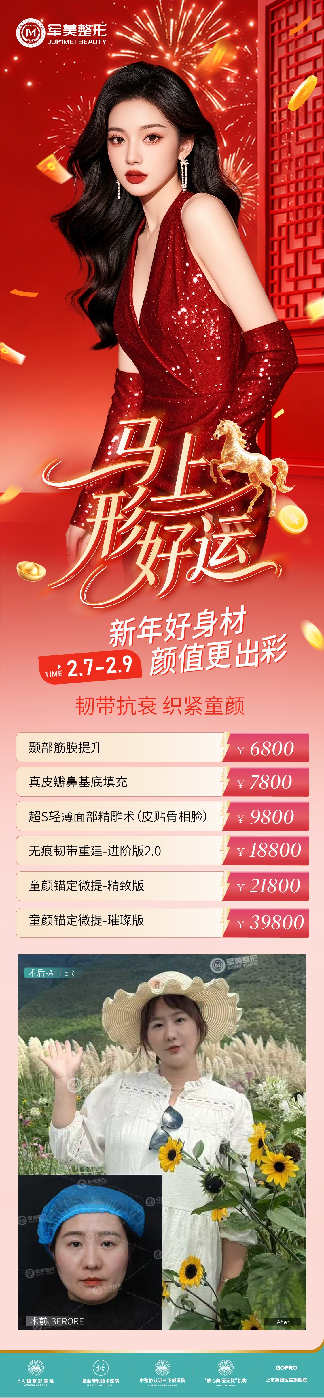 韧带抗衰 织紧童颜